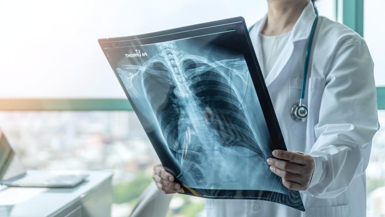 doctor looking at a vertebra radiography