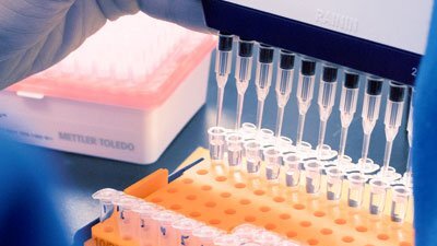 microvolume dispensing