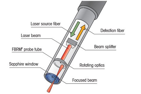 Lasentec FBRM 측정 방법