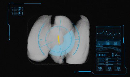 Webinar: Advanced Detection of Bone with X-ray Inspection