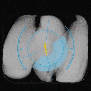 Webinar: Advanced Detection of Bone with X-ray Inspection Webinar: Advanced Detection of Bone with X-ray Inspection